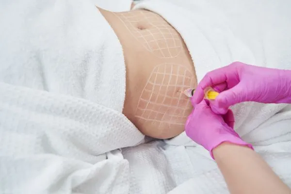 image of fat dissolving injections on love handles to help combat weight gain West Drayton
