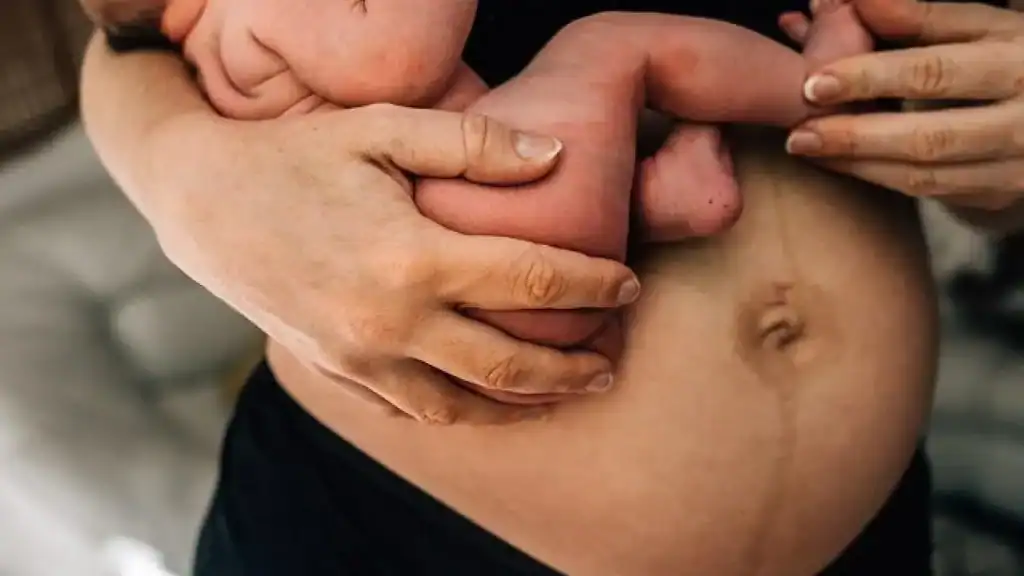 Why Is My Stomach Still Big After Pregnancy West Drayton?